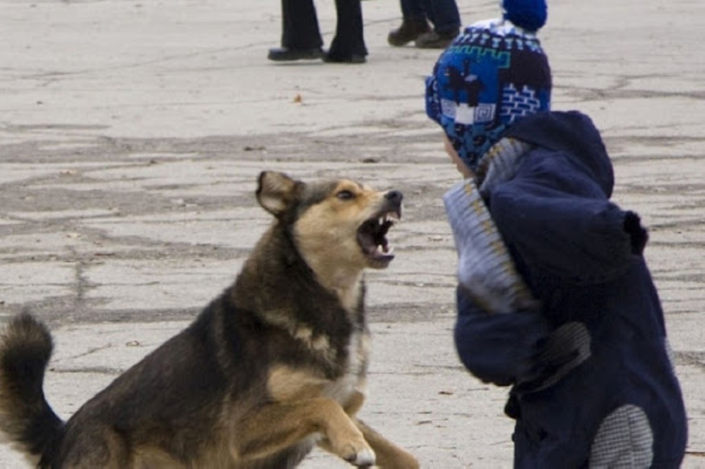 ՌԴ-ում փողոցային շները հարձակվել են 9-ամյա երեխայի վրա ու ավելի քան 100 անգամ կծել նրան